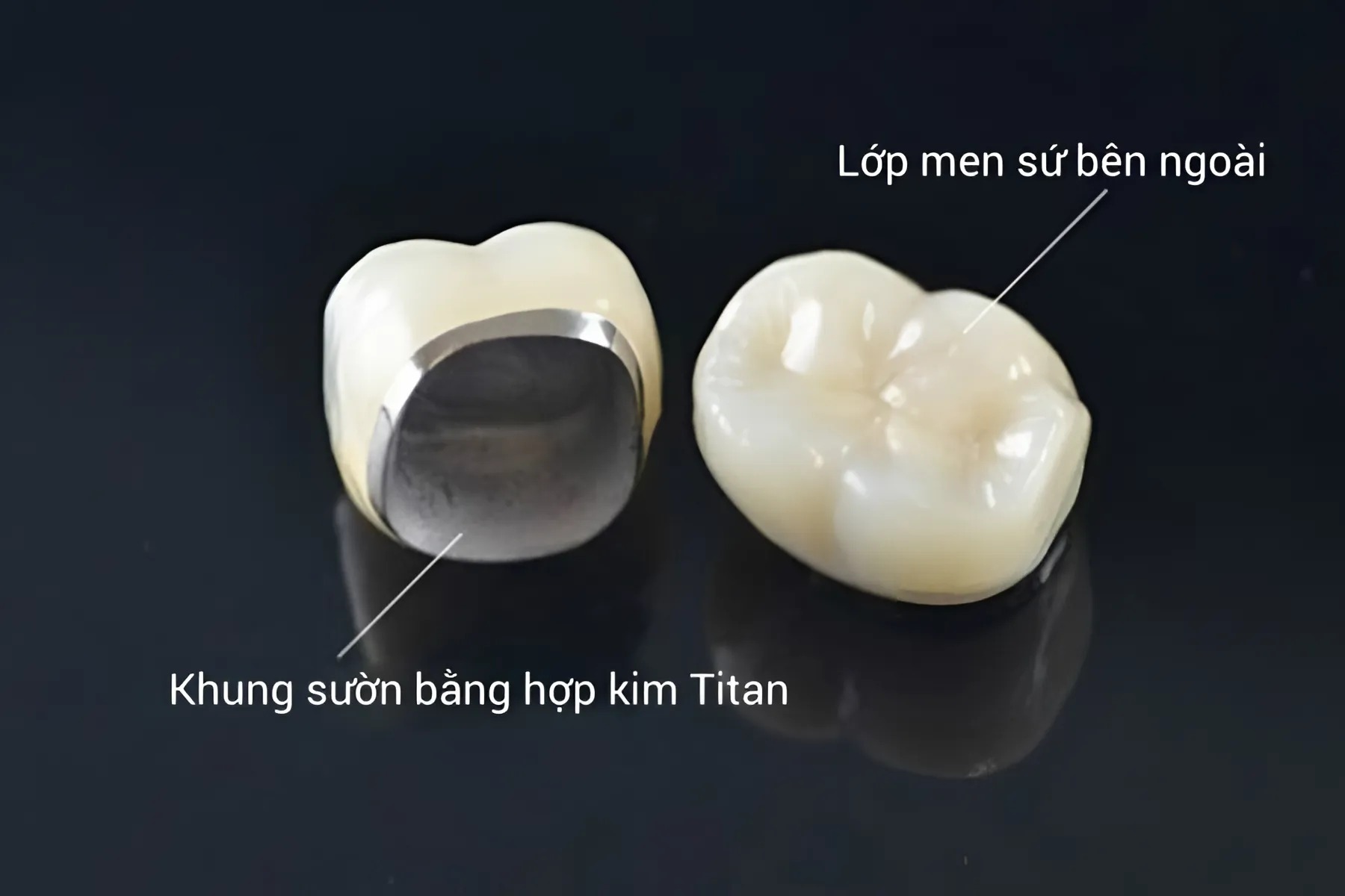 Titan khá lành tính, ít gây kích ứng hơn hợp kim thường